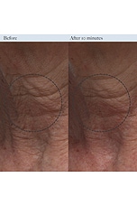 Resurfacing Enzyme Polish - thumbnail 5
