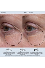 Tightening Eye Gel - thumbnail 6