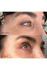 Occlusion Eyes & Mouth Patches - thumbnail 5