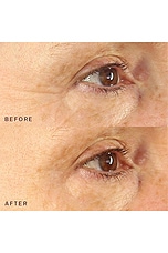 Occlusion Eyes & Mouth Patches - thumbnail 6