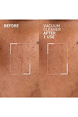 Pores No More Vacuum Cleaner Mask - thumbnail 5