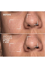 Pores No More Vacuum Cleaner Mask - thumbnail 6