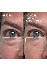 Needles No More No More Baggage Eye De-Puffing Gel - thumbnail 5