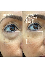 Needles No More No More Baggage Eye De-Puffing Gel - thumbnail 7