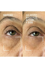 Needles No More No More Baggage Eye De-Puffing Gel - thumbnail 8