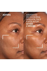 Advanced Microdermabrasion Renewing Face Exfoliator - thumbnail 8