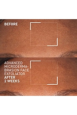 Advanced Microdermabrasion Renewing Face Exfoliator - thumbnail 9