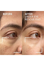 Eye Rescue Duo - thumbnail 10