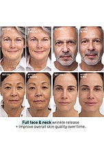 Needles No More Wrinkle Release Serum - thumbnail 6