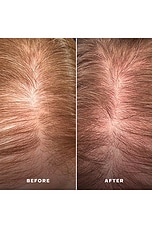 Everboost Scalp Serum - thumbnail 9