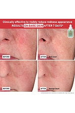 Centella Red Serum for Visible Redness & Immediate Soothing Effect on Sensitive Skin - thumbnail 8