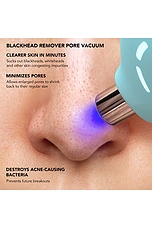 KIWI Blackhead Remover Device - thumbnail 8