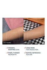 Peach 2 Pro Max IPL Hair Removal Device - thumbnail 9