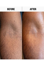Resurfacing Targeted Body Lotion - thumbnail 6