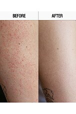 Resurfacing Targeted Body Cleanser - thumbnail 6