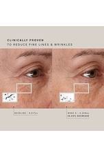 Red Light Face Mask - thumbnail 10
