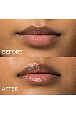 Lip Remedy Mask - thumbnail 8