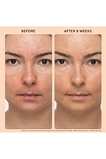 That Overnight Hustle AHA + BHA Resurfacer - thumbnail 6