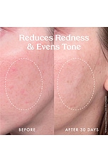 Star Bright Discoloration Correcting Serum - thumbnail 10