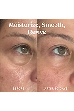 Ceramide & Retinol Dual-Core Eye Balm - thumbnail 10