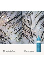 Dry Scalp Treatment - thumbnail 7
