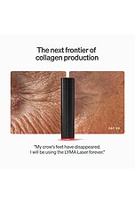 Laser Starter Kit - thumbnail 7