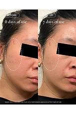 Aura Cleanse Foaming Gel Cleanser - thumbnail 6