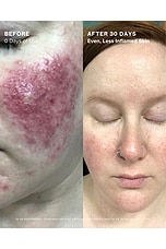 Evening Primrose + Green Tea Algae Retinol Face Oil - thumbnail 6