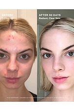 Evening Primrose + Green Tea Algae Retinol Face Oil - thumbnail 8