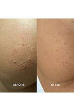 Travel Mint Bum + Body Cream - thumbnail 8