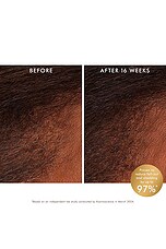 Revitalizing Scalp Tonic Treatment - thumbnail 6