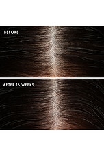 Revitalizing Scalp Tonic Treatment - thumbnail 7