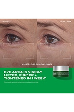 Retinal Resculpt Eye Treatment - thumbnail 6