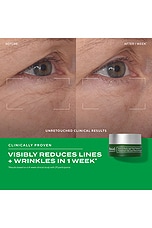 Retinal Resculpt Eye Treatment - thumbnail 7