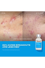 Deep Relief Acne Treatment - thumbnail 7