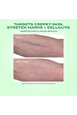 Retinal Resculpt Body Treatment - thumbnail 6