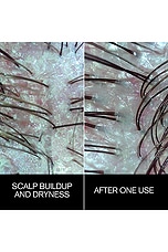 Follicle Drops - thumbnail 7