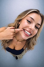 Tooth Gem Kit - thumbnail 9