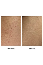 Bump Barrier Oil For Ingrown Hairs - thumbnail 8