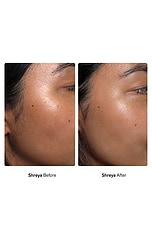 Facial Dermaplaners 12 Pack - thumbnail 10
