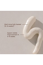 Scar Treatment - thumbnail 6