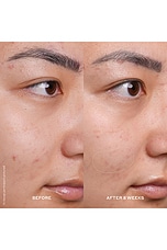 Banana Bright 15% Vitamin C Serum - thumbnail 7