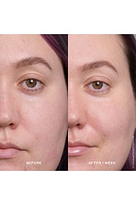 Banana Bright 15% Vitamin C Serum - thumbnail 8