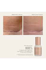 Complex Scar Serum - thumbnail 9