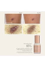 Complex Scar Serum - thumbnail 10