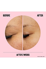 Microneedling Anti-Wrinkle Retinol Patches - thumbnail 6