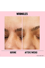 Microneedling Anti-Wrinkle Retinol Patches - thumbnail 7