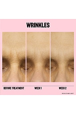 Microneedling Anti-Wrinkle Retinol Patches - thumbnail 8