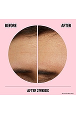 Microneedling Anti-Wrinkle Retinol Patches - thumbnail 9