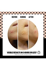 Salicylic Acid Acne Healing Dots 20 Dots - thumbnail 6